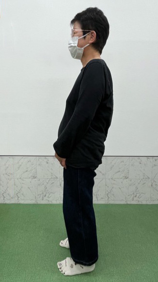 beforeの写真