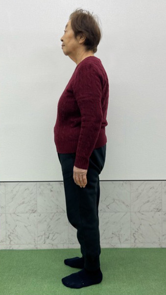 beforeの写真
