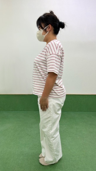 beforeの写真